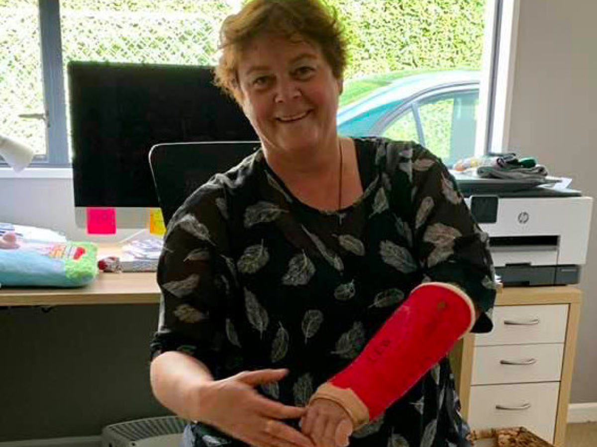 Chandra shows off her broken wrist in its bright red cast.